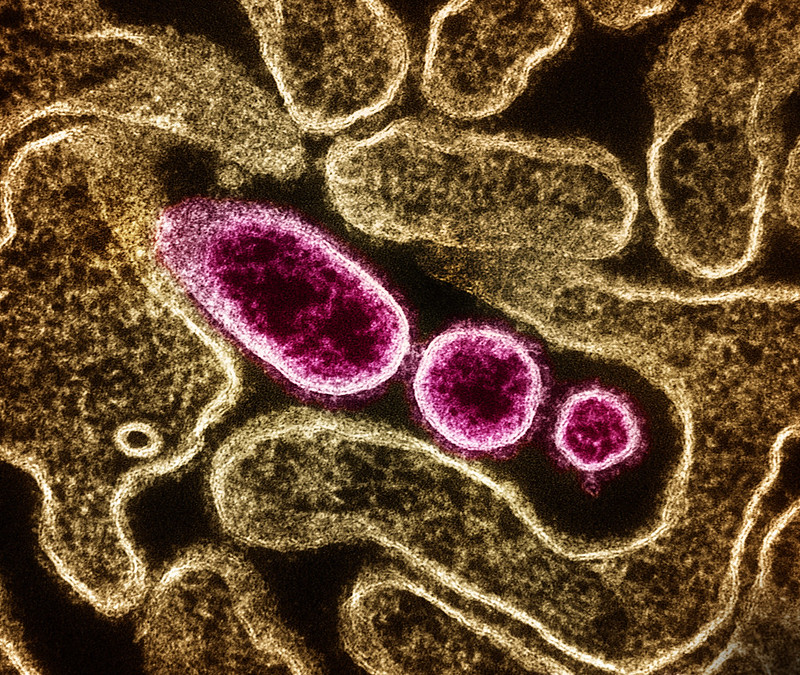 Oxford launches first human trial of its Nipah virus vaccine candidate ...